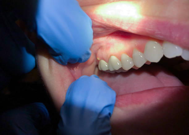Best Emergency Orthodontic Repairs in Redwood, TX